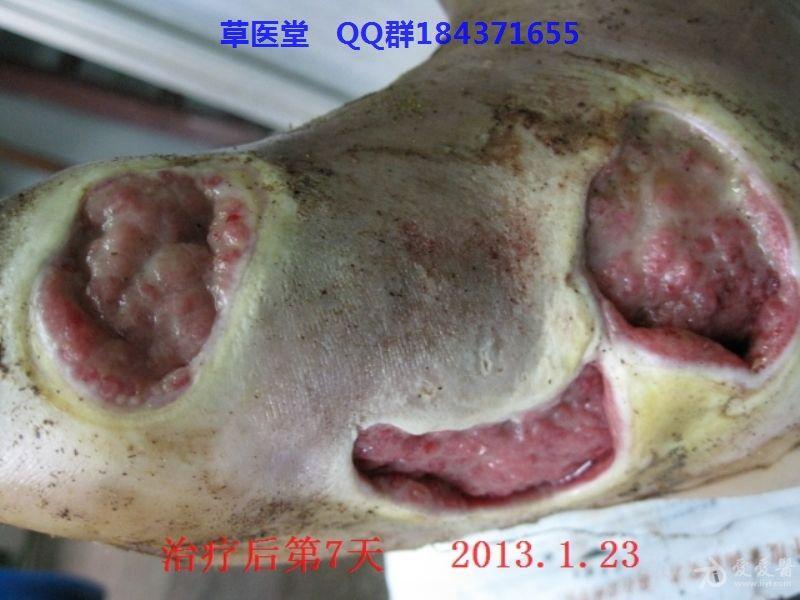 疮疡 www.iiyi.com
