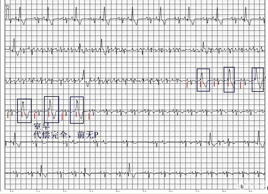 心电图读图第十六期(参考答案已公布)