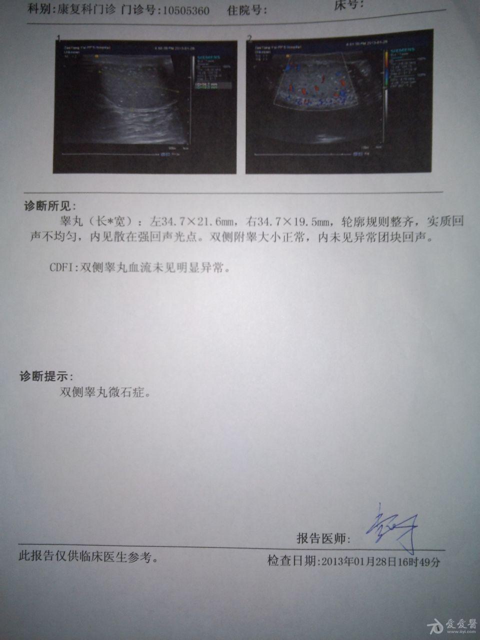 彩超双侧睾丸微石症会不孕不育吗?