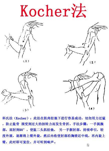 肩关节脱位方法和技巧征集专贴
