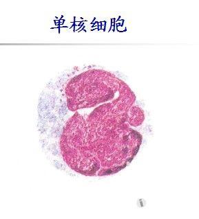 如何区分中性杆状粒和单核细胞?