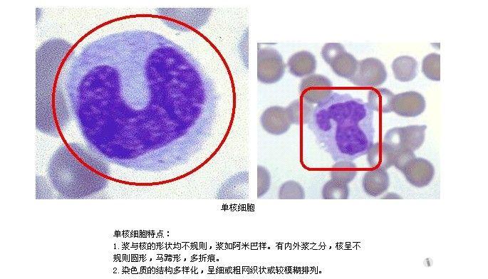 如何区分中性杆状粒和单核细胞