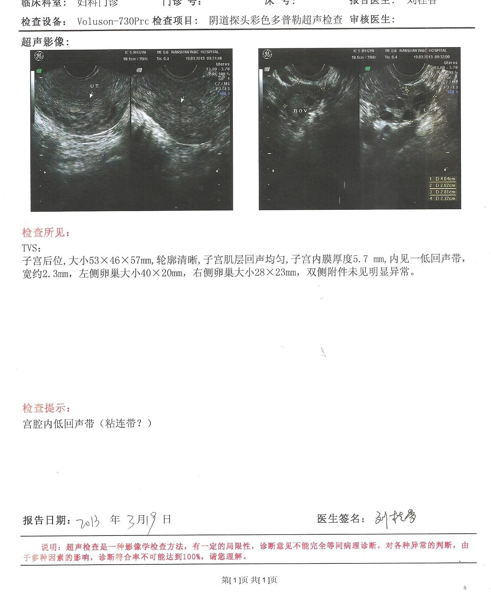 请专业人士帮忙分析下我的两次阴超检查结果是否排除宫腔粘连
