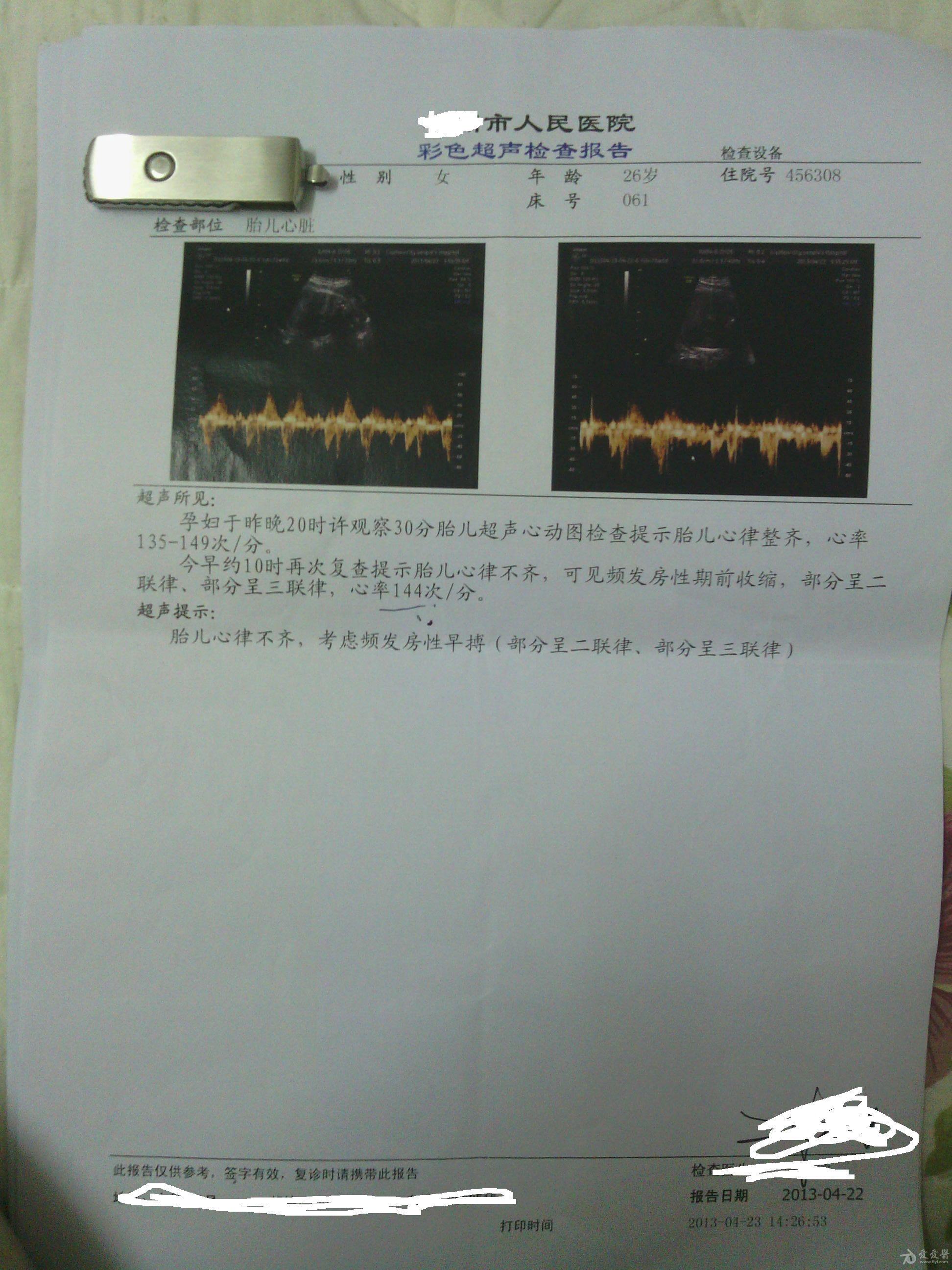 22日上午心脏彩超.jpg