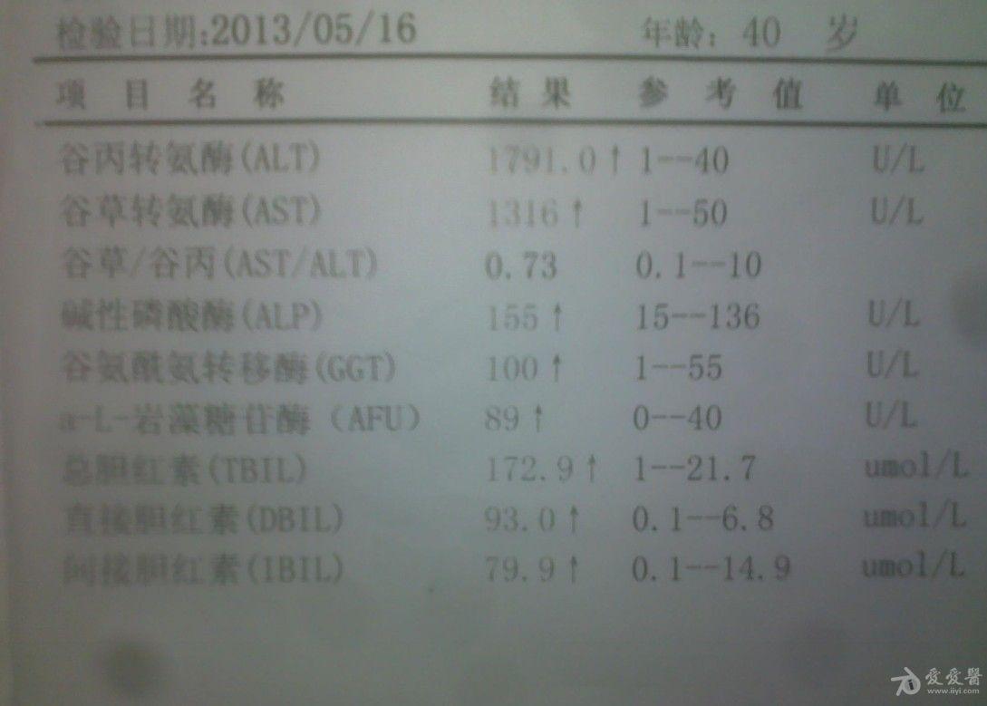 乏力纳差1月皮肤黄染20天