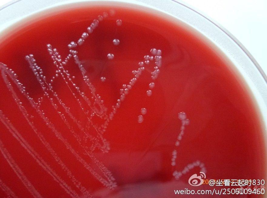 【11周年庆病例征集—中段尿一般细菌培养血平板培养出淋球菌?