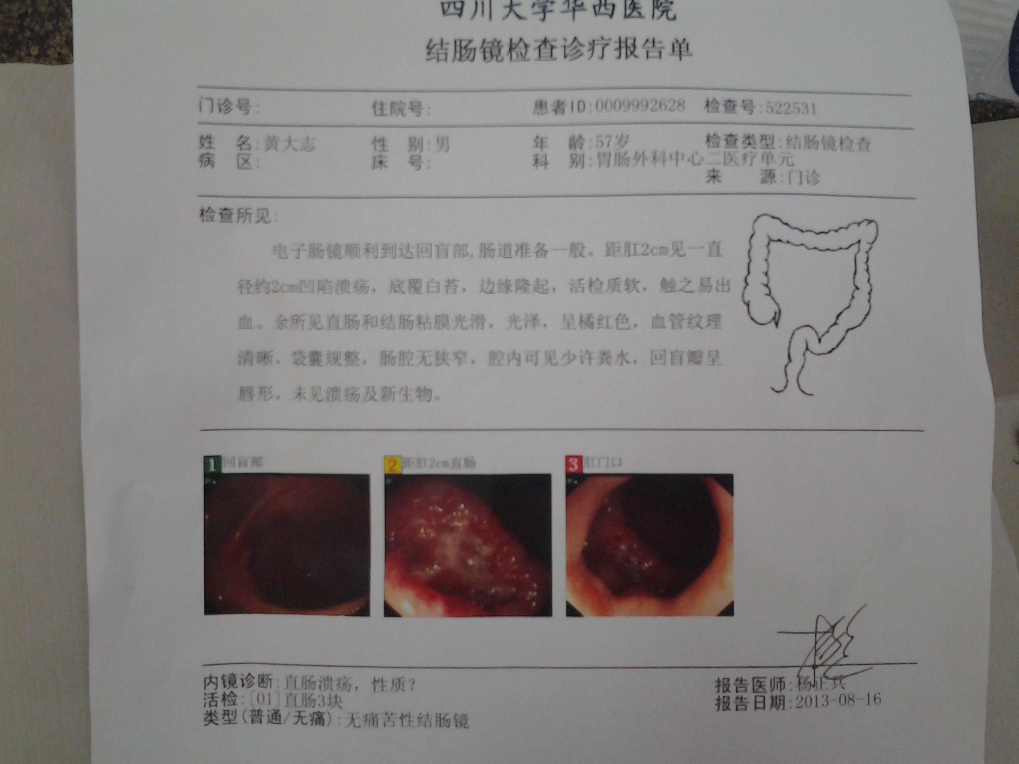 能帮我看看这个肠镜结果吗直肠癌的可能性大吗