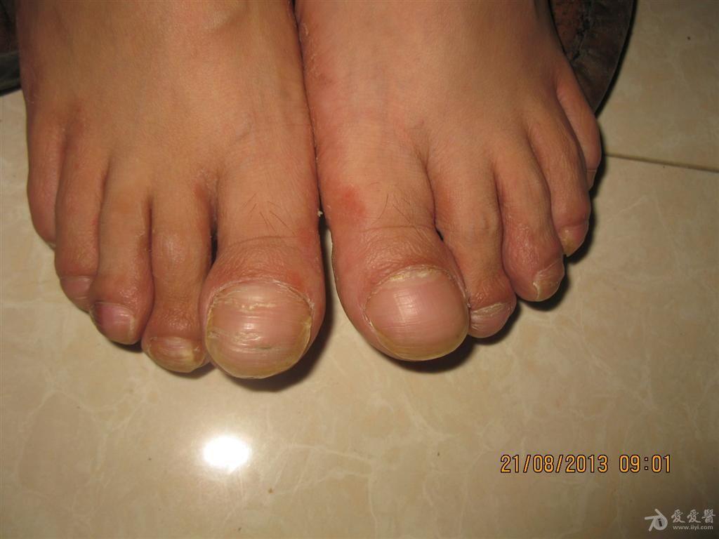 女人漂亮的的脚趾头图片，长得好看的脚图片-1-6图