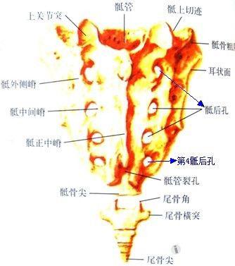 骶管麻醉失败的常见原因分析