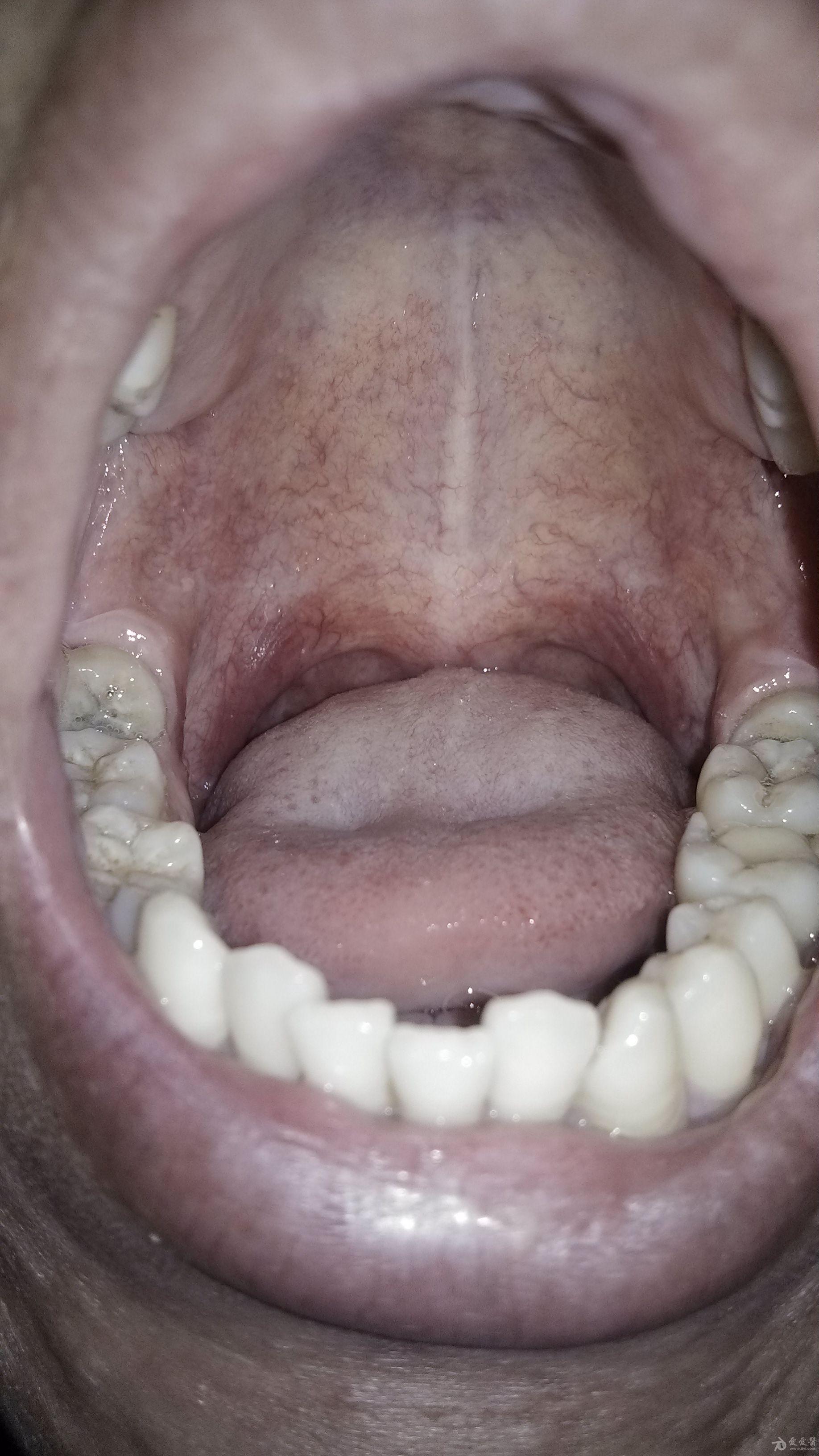 请大家分析病理,寒热等