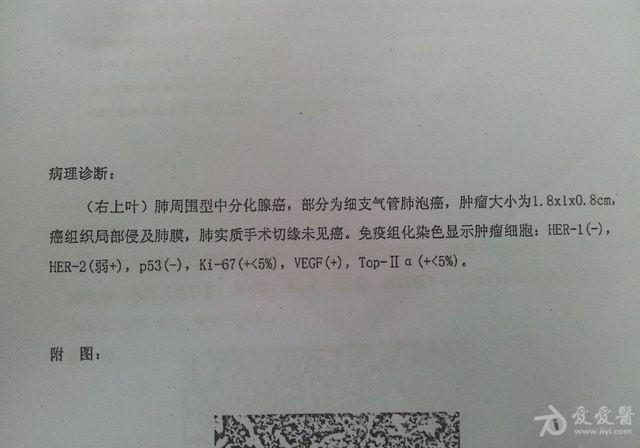 肺癌免疫组化