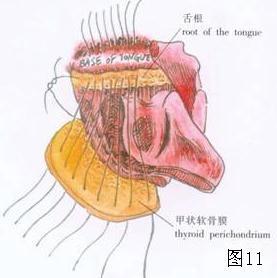 耳鼻咽喉头颈外科手术征集保留喉功能的梨状窝癌切除术