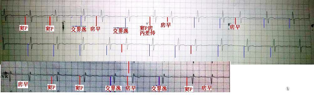 交界性逸博?