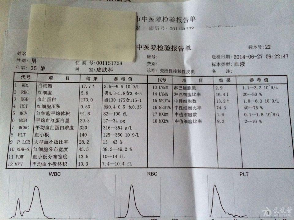 辅助检查和处方如下图,大夫考虑中毒性红斑,输液治疗的同时给予雷公藤