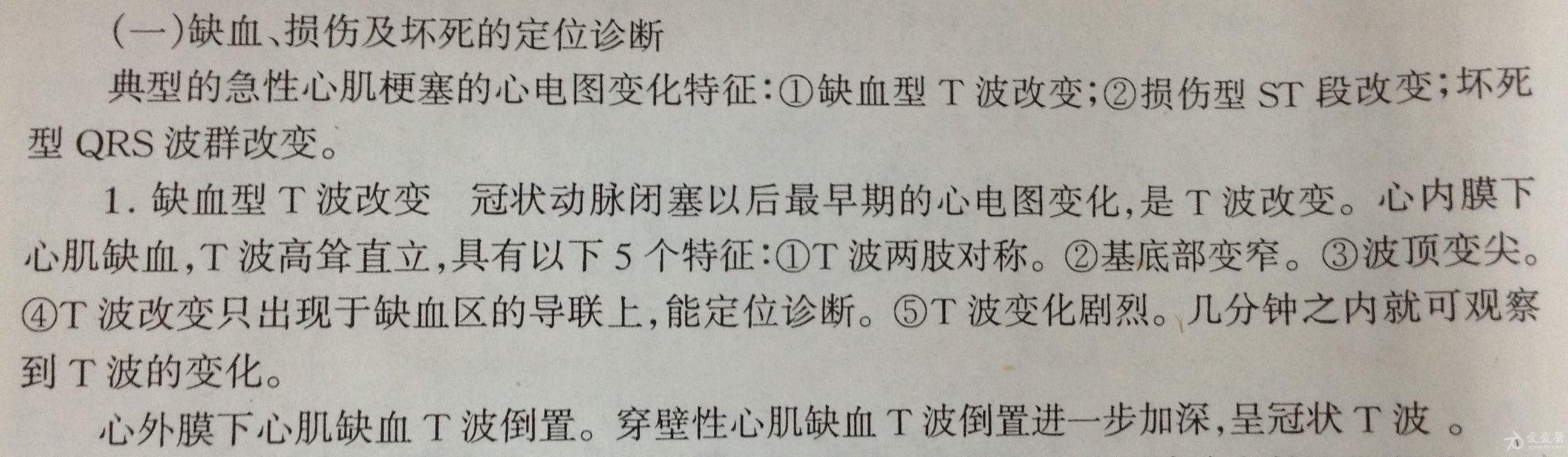 前间壁r波递增不足和超急性前间壁心肌梗死