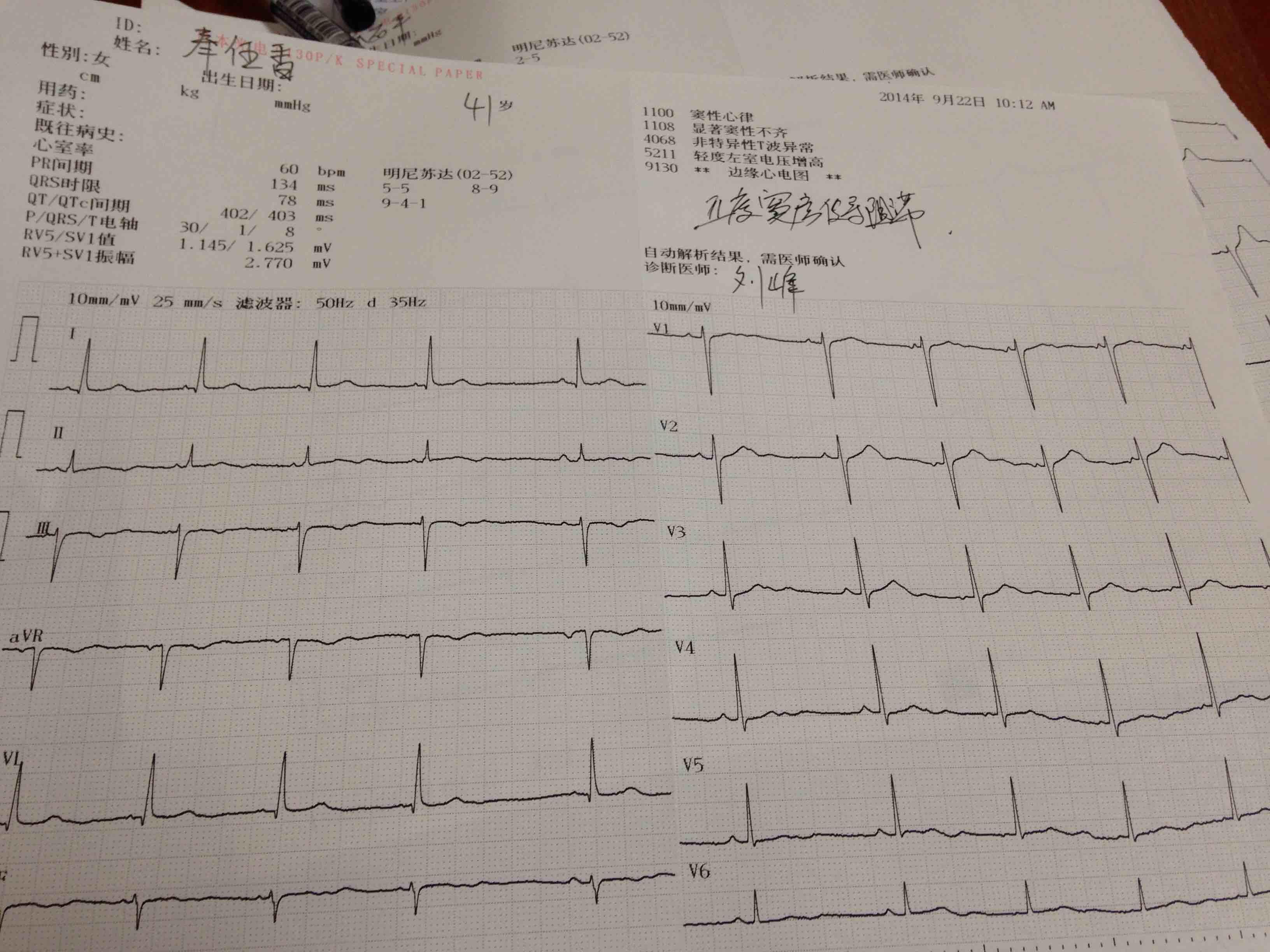 窦房阻滞 心电图脑电图专业讨论版 爱爱医医学论坛