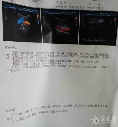 "疑难"讨论:腰间盘突出症漏诊一例——小结在21楼,讨论在26楼