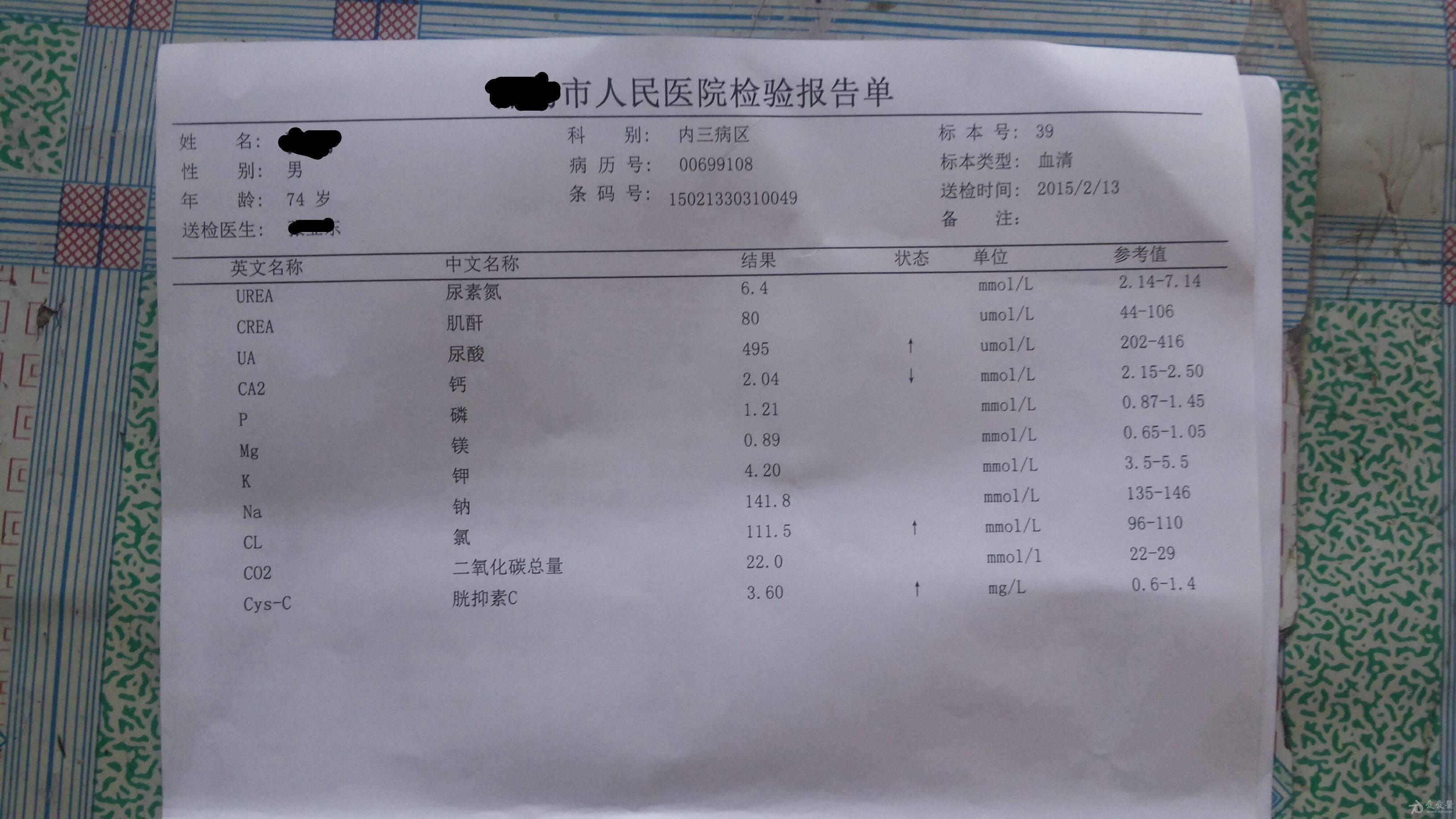 23%x-14%x=14解方程