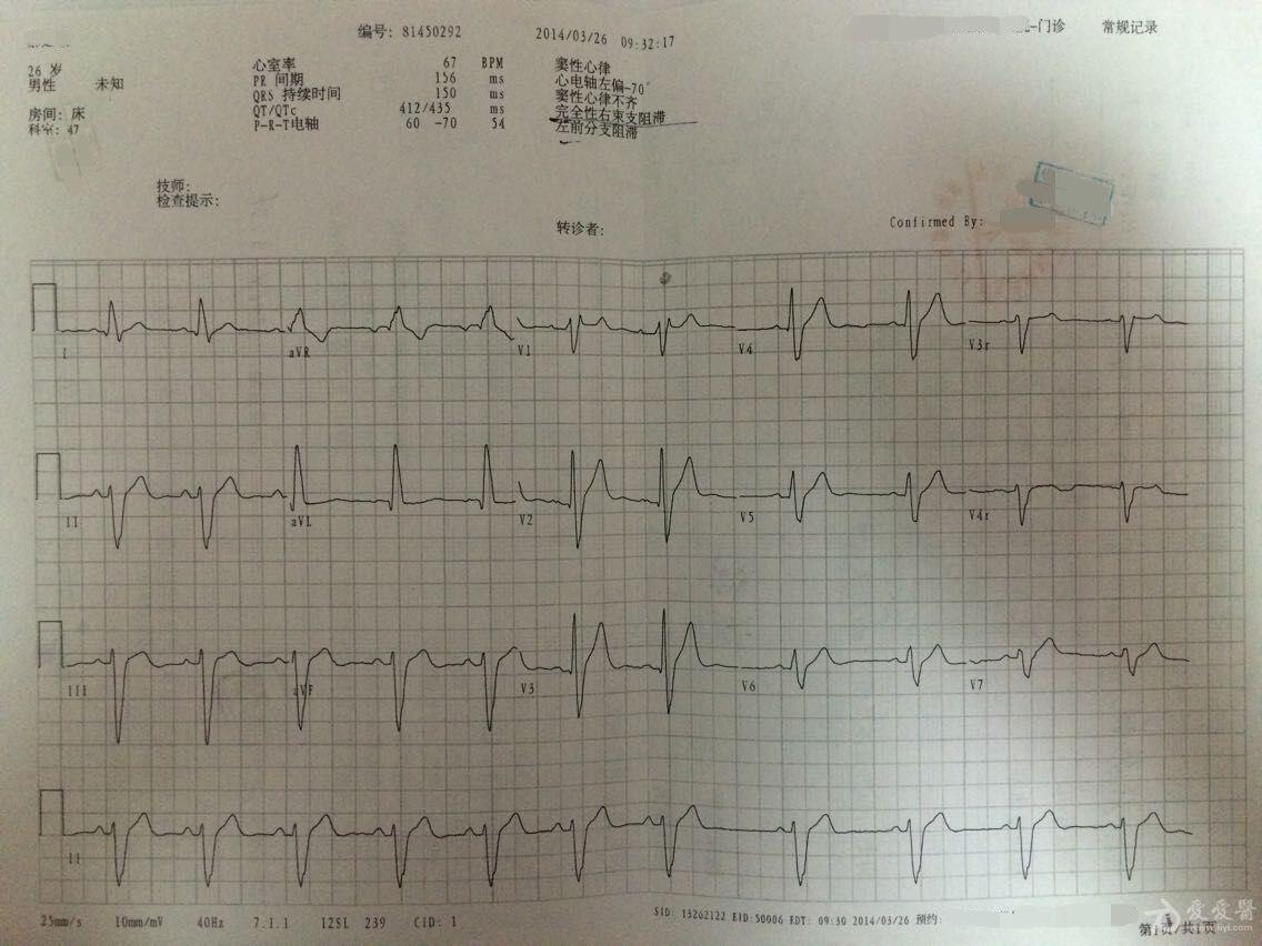 这是我个人的一份心电图检测报告,提供学习并望答疑!