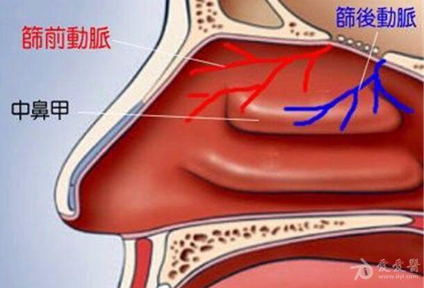 3筛前动脉2.jpg