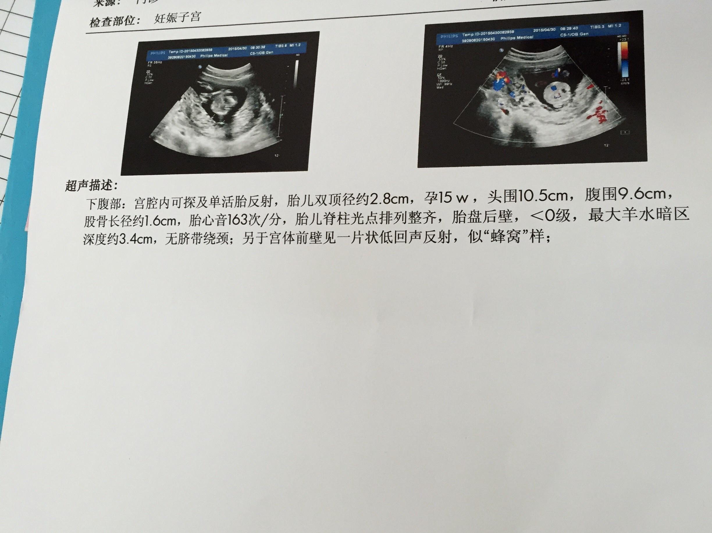 孕三月半,医生怀疑转部分性葡萄胎.急!