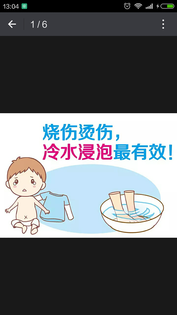 宝宝烫伤急救请看-图片