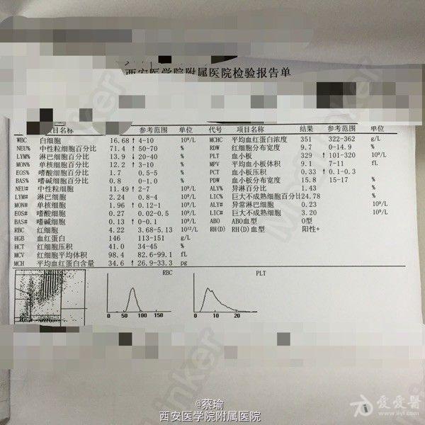 腹腔镜下的诊治:急性阑尾炎 不典型胃肠穿孔