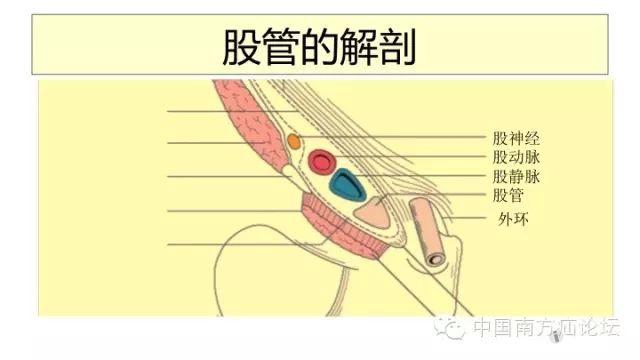 【转帖】再谈股疝