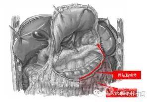 腹腔镜下全胃切除,d2淋巴清扫的手术步骤及解剖要点