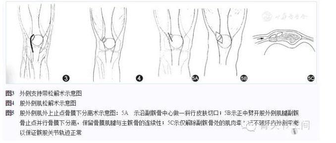 mori等[[url=]19[/url]]对15例16膝疼痛性二分髌骨进行了镜下外侧支持