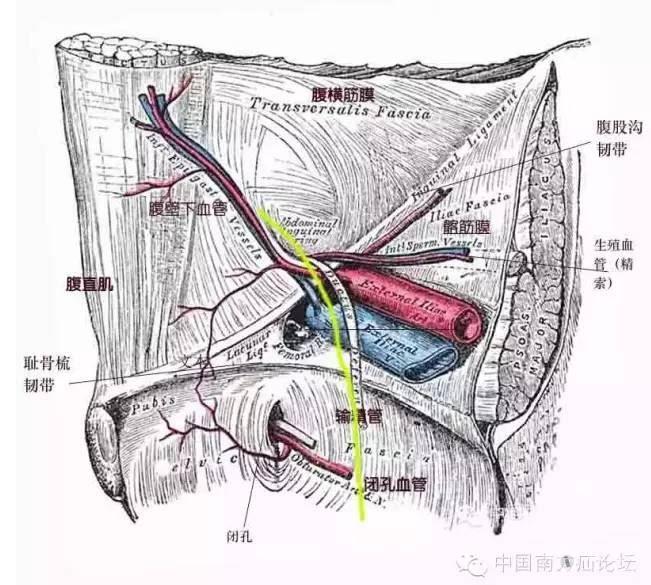 腔镜下腹股沟疝解剖(二)间隙篇