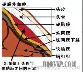 轻松学头颅外伤ct  (左图示左侧硬膜下新月形低密度影,系血肿吸收期