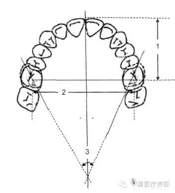 口腔美容nance弓和横腭杆在拉尖牙远移中支抗效果的研究