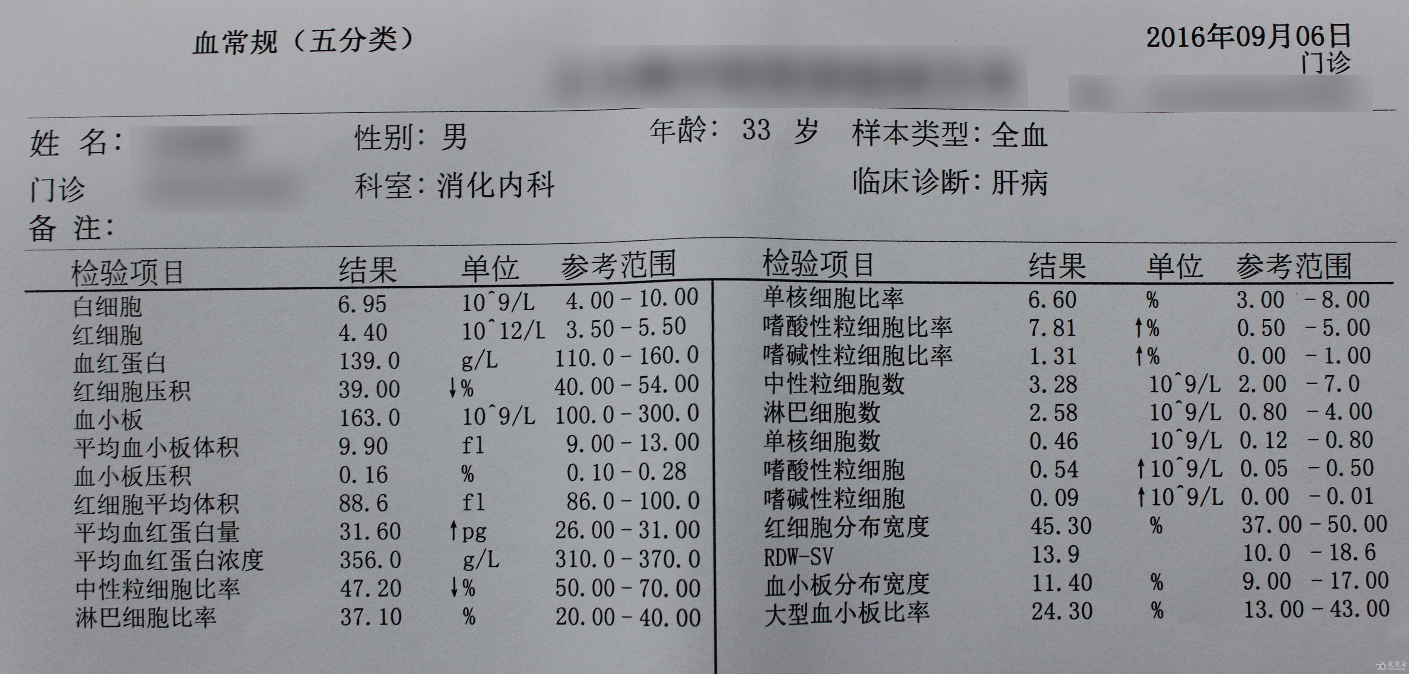 求助 请问肝病专家,这个早期肝硬化的表现吗?