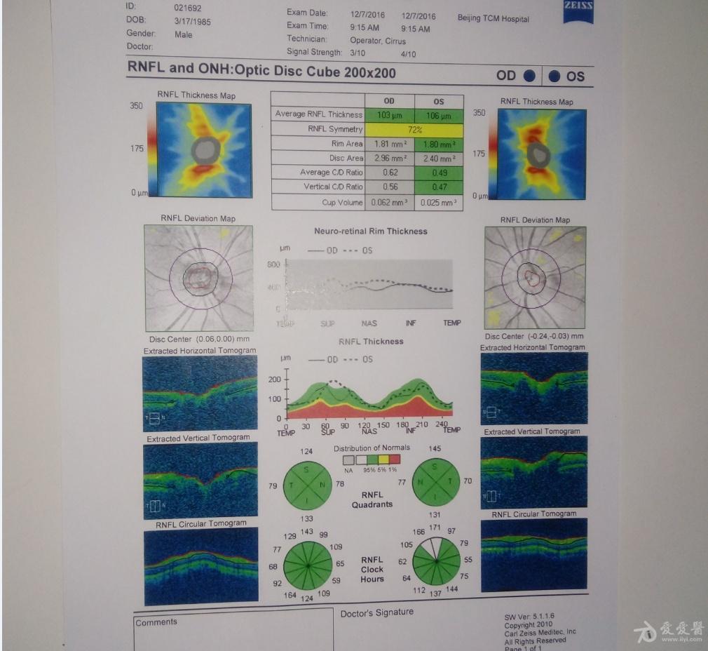近一个月眼睛不舒服做了oct检查但是看不懂请大家帮帮忙