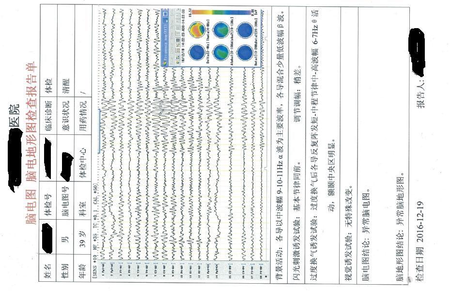 新人脑电图异常请大神帮忙解读