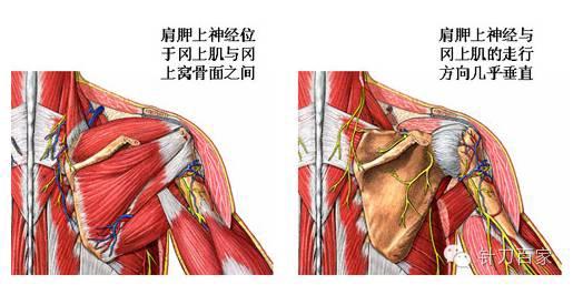 疑难肩部问题,冈上肌有可能是核心