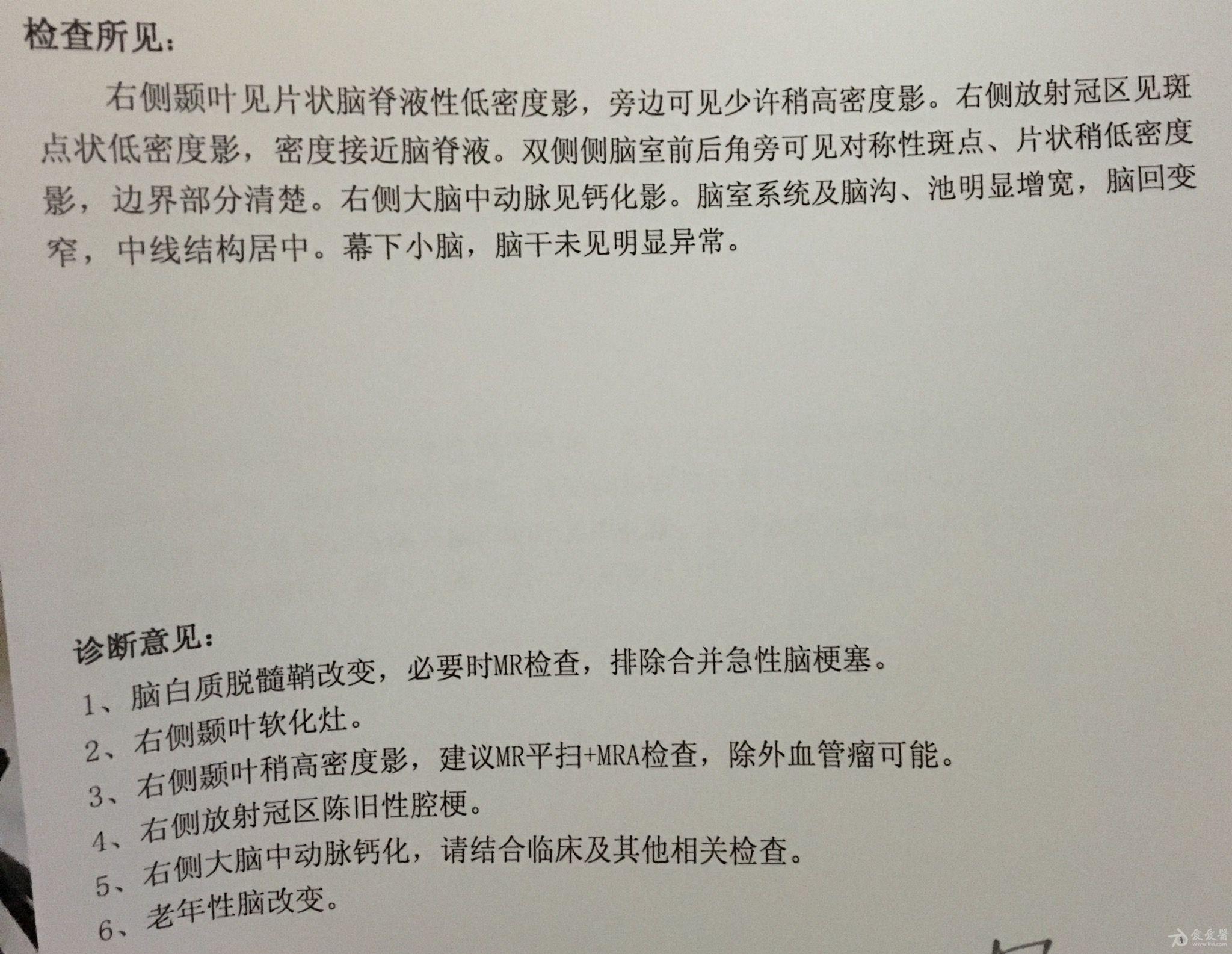 充ct报告单