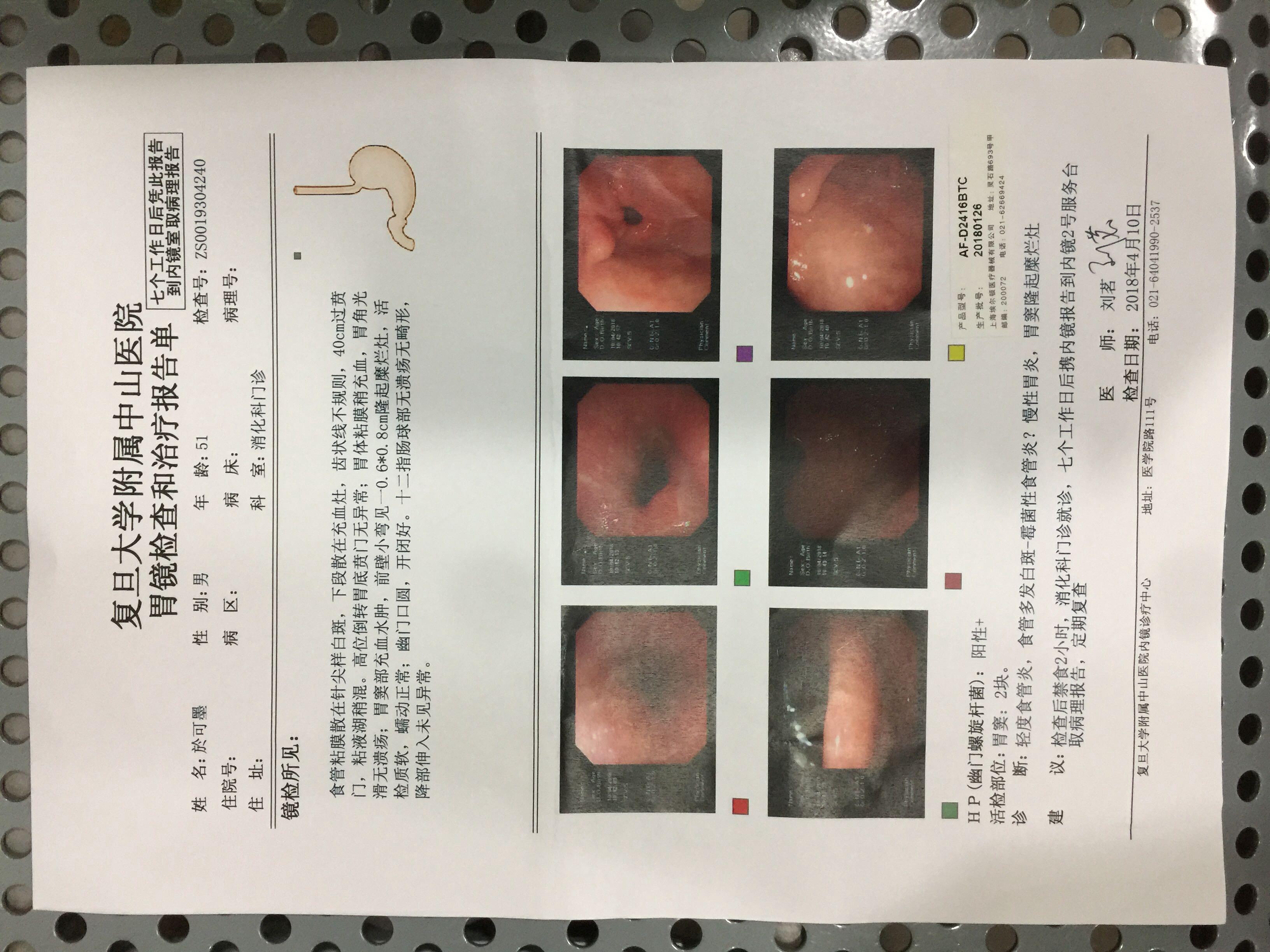 胃镜查解读