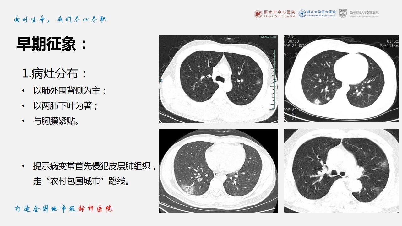 新冠肺炎ct早期征象与临床基础及鉴别诊断