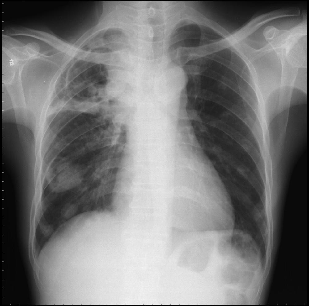 【贴图】少见x光片资料共享(第13次更新2006-1-13)