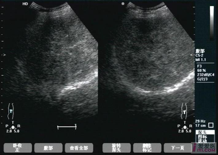 超聲醫學討論版 - 愛愛醫醫學論壇 - 愛愛醫醫學網