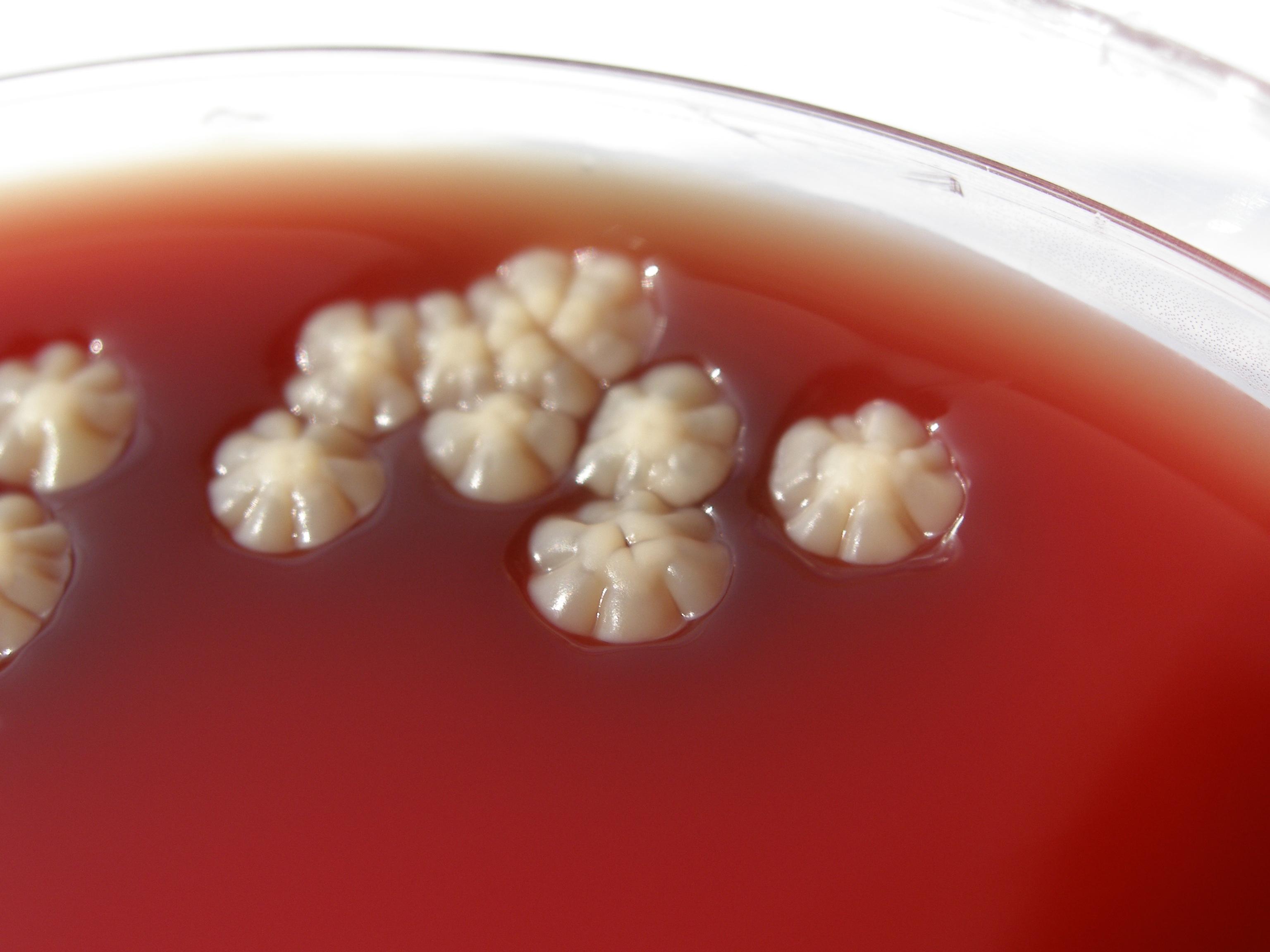 【转贴】奴卡菌照片