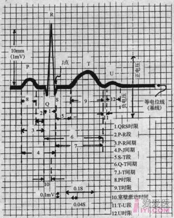 正常心电图的判读