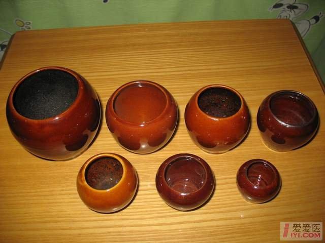 【专业组】拔火罐的目的与方法?--欢迎大家讨论!