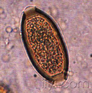 鞭虫卵显微镜下图图片