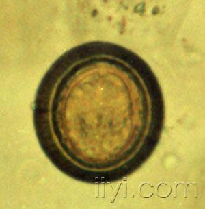 犬复孔绦虫孕卵节片图片