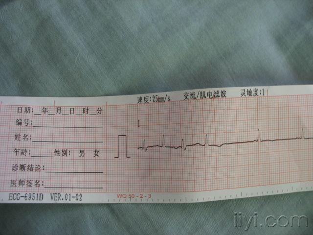 很經典的心電圖,歡迎大家來討論