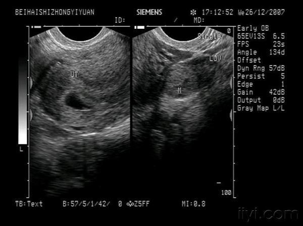 超聲醫學討論版 - 愛愛醫醫學論壇 - 愛愛醫醫學網