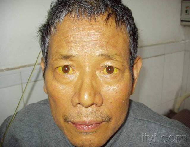 消化系疾病体征照片集(申请加精)